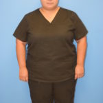Gastric Sleeve Before & After Patient #548